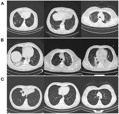 COVID-Net CT-2: Enhanced Deep Neural Networks for Detection of COVID-19 From Chest CT Images Through Bigger, More Diverse Learning